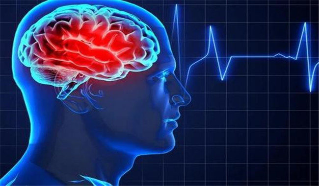 腦血管病的種類(lèi)及形成原因