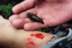 螞蟥咬人怎么辦？螞蟥怎么能殺死？